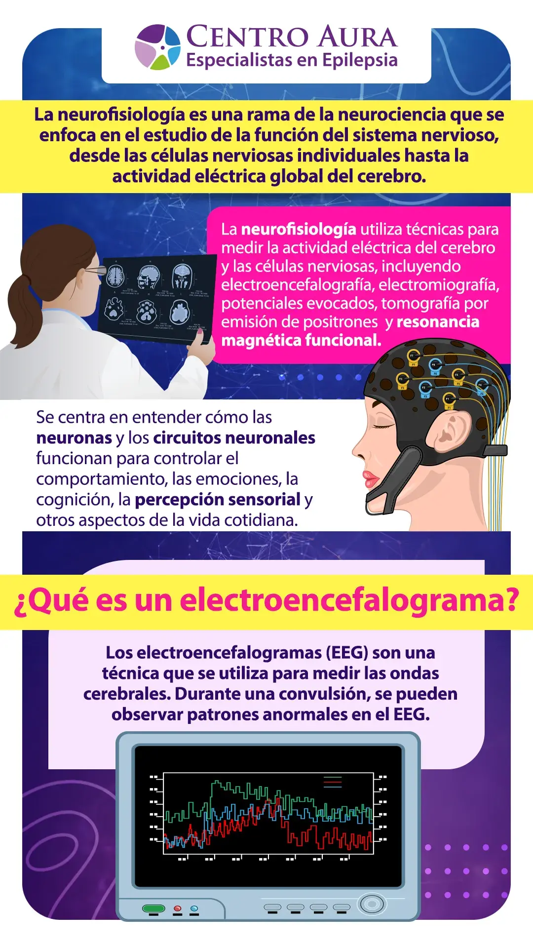 ¿Qué es la neurofisiología en la epilepsía?